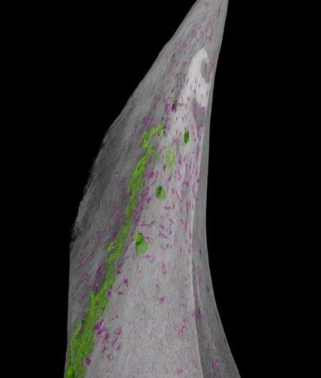 How fish evolved their bony, scaly armor